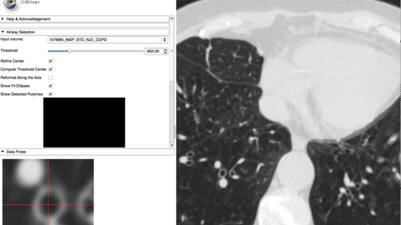 Airway Inspector Screenshoot