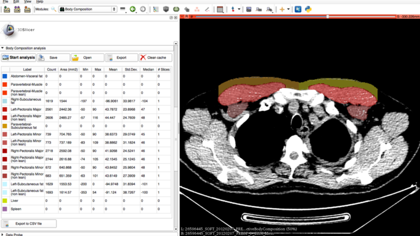 Body Composition Screenshot
