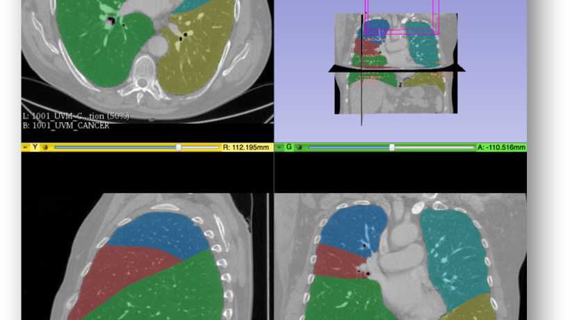 Interactive Lobe Segmentation Screenshot