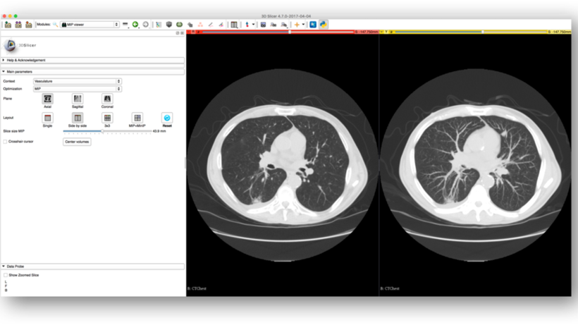 MIP Viewer Screenshot