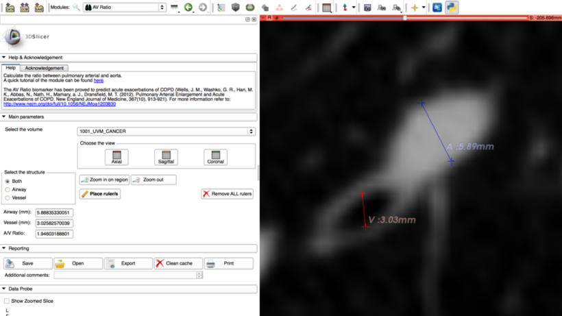 AV Ratio screenshot